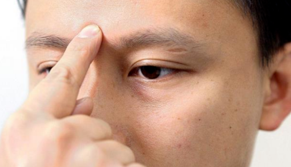 把手指放在眉心附近,会有奇怪的感觉,这是怎么回事?(图1) 29.png
