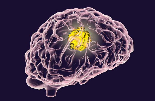 把手指放在眉心附近,会有奇怪的感觉,这是怎么回事?(图6) 34.png