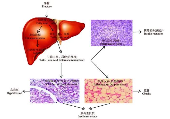 警惕!这些饮料,也会引发痛风!快看看你是不是每天都在喝?(图4) 5.jpg