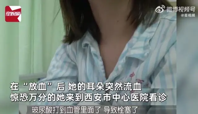 空姐注射玻尿酸打进血管,差点丧命!头扎200多针被“放血”,官方:涉事医生还没找到(图6) 空姐注射玻尿酸打进血管,差点丧命!头扎200多针被“放血”,官方:涉事医生还没找到(图6)