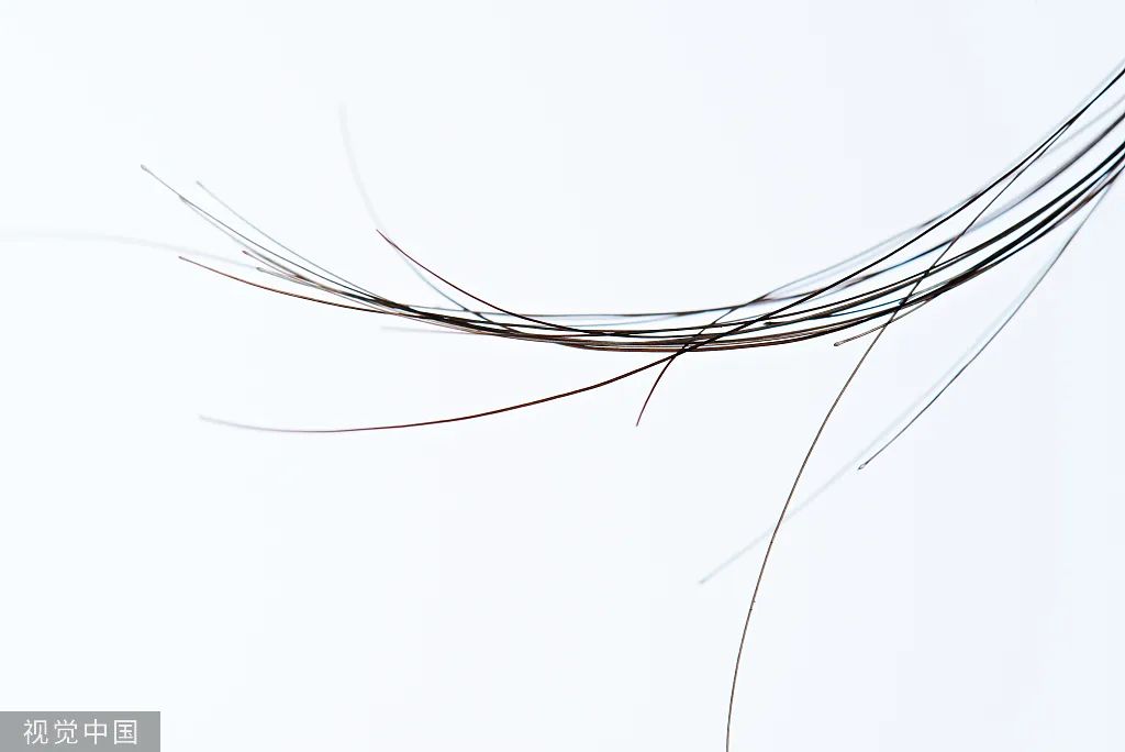 白头发拔一根长三根?到底该不该拔?终于弄清楚了!(图2) 31.jpg