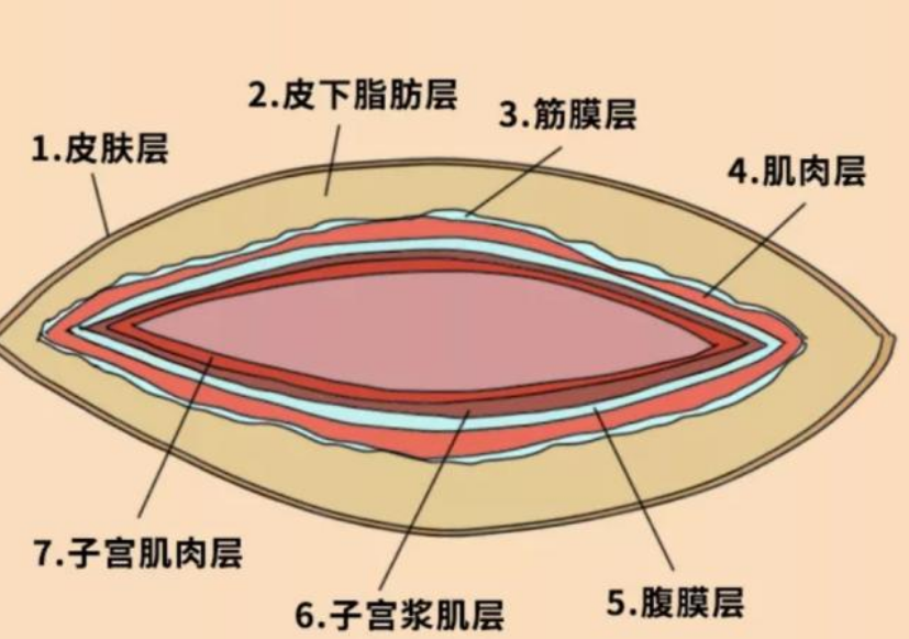 与动物相比,为何人类女性生孩子如此困难?(图4) 25.png