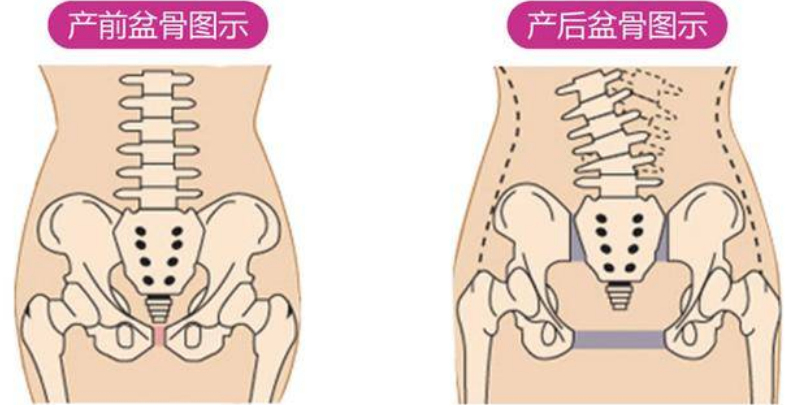 与动物相比,为何人类女性生孩子如此困难?(图9) 30.png