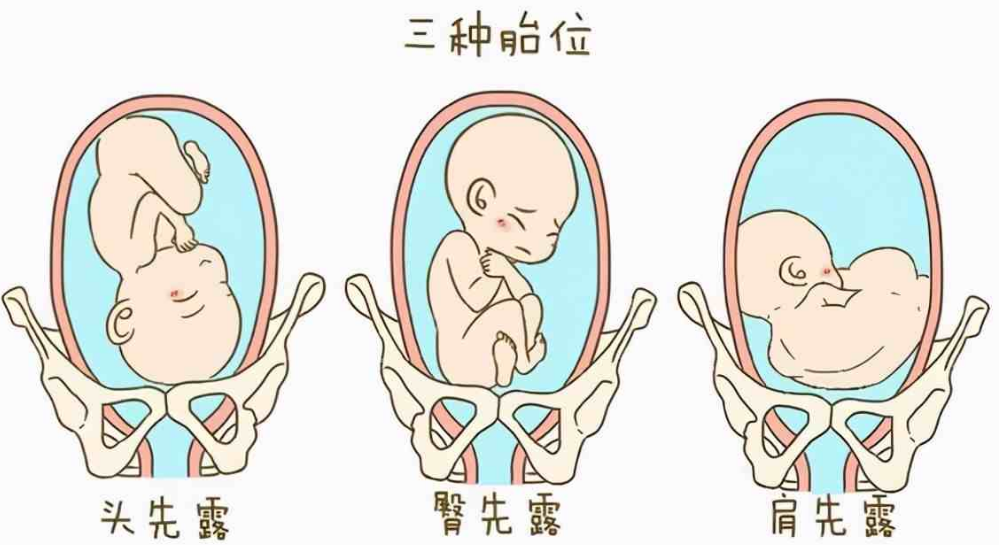 与动物相比,为何人类女性生孩子如此困难?(图10) 31.png