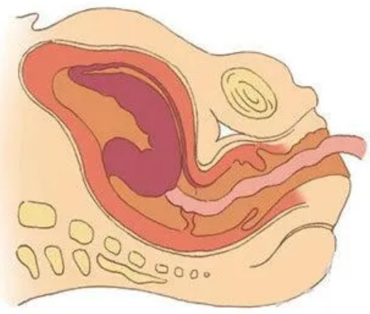 与动物相比,为何人类女性生孩子如此困难?(图11) 32.png
