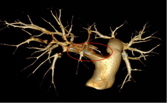 不小心扭伤,竟致心跳骤停!警惕这个沉默的“杀手”(图1) 2.png