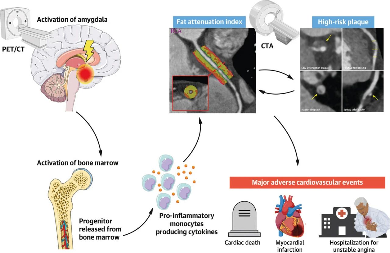 生气时为什么容易心梗猝死?看完再也不敢随便生气了!(图1) 1.jpg