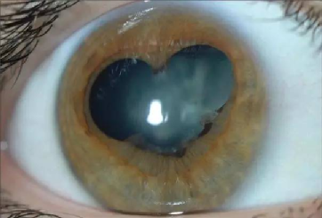 一网友的瞳孔突然变成三角形:“不会是中国首例吧?” 医院确诊为……(图3) 14.png