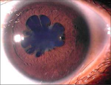 一网友的瞳孔突然变成三角形:“不会是中国首例吧?” 医院确诊为……(图4) 15.png