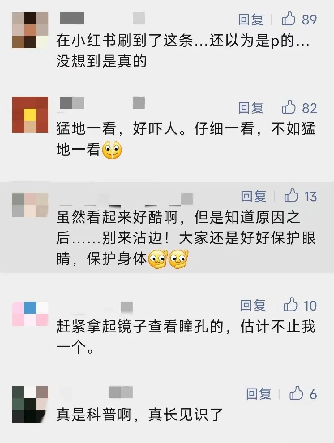 一网友的瞳孔突然变成三角形:“不会是中国首例吧?” 医院确诊为……(图7) 18.jpg