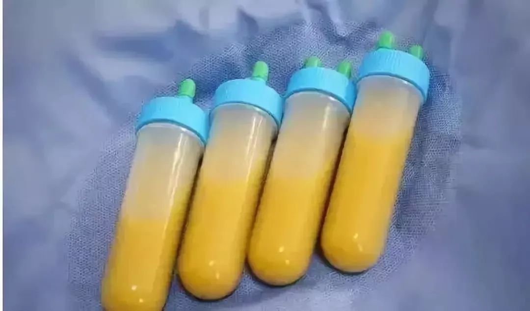 口服粪便胶囊:一种新的辅助抗癌方法(图4) 13.jpg