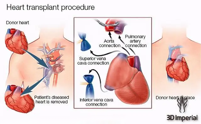 明明是最高等生物,人类生理结构却有很多不合理,为什么?(图10) 10.png