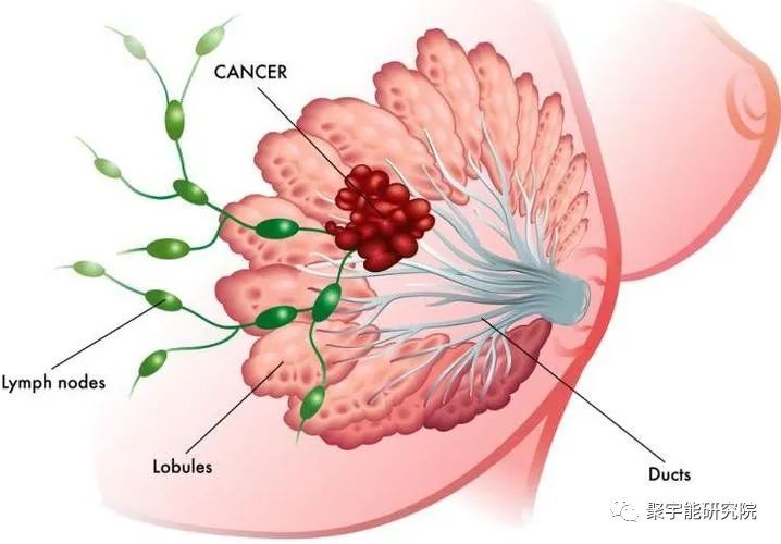 金日光教授:【《黄帝内经》漫谈•之六】林佳媚主任很想知道女性乳腺癌里生命动力阴阳源精分布(图2) 2.jpg