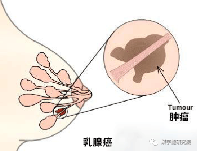 金日光教授:【《黄帝内经》漫谈•之六】林佳媚主任很想知道女性乳腺癌里生命动力阴阳源精分布(图4) 4.png