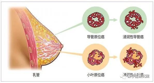 金日光教授:【《黄帝内经》漫谈•之六】林佳媚主任很想知道女性乳腺癌里生命动力阴阳源精分布(图5) 5.jpg