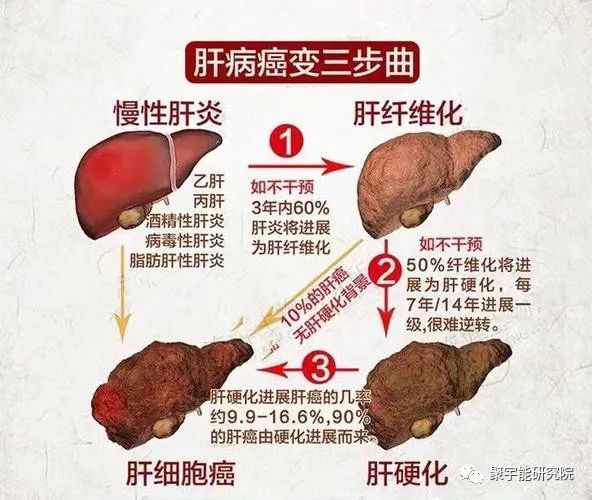 金日光教授:【《黄帝内经》漫谈•之七】肝癌的阴阳精及精气(图3) 3.jpg