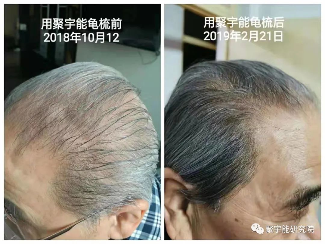 金日光教授:【《黄帝内经》漫谈•之十七】聚宇能型神龟梳放在肝位上,对十二正经原穴引起的奇事(图4) 58.jpg