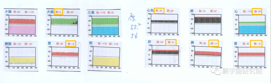 金日光教授:【《黄帝内经》漫谈•之二十】聚宇能生命动力液也有的瞑眩反应?(图8) 6.png