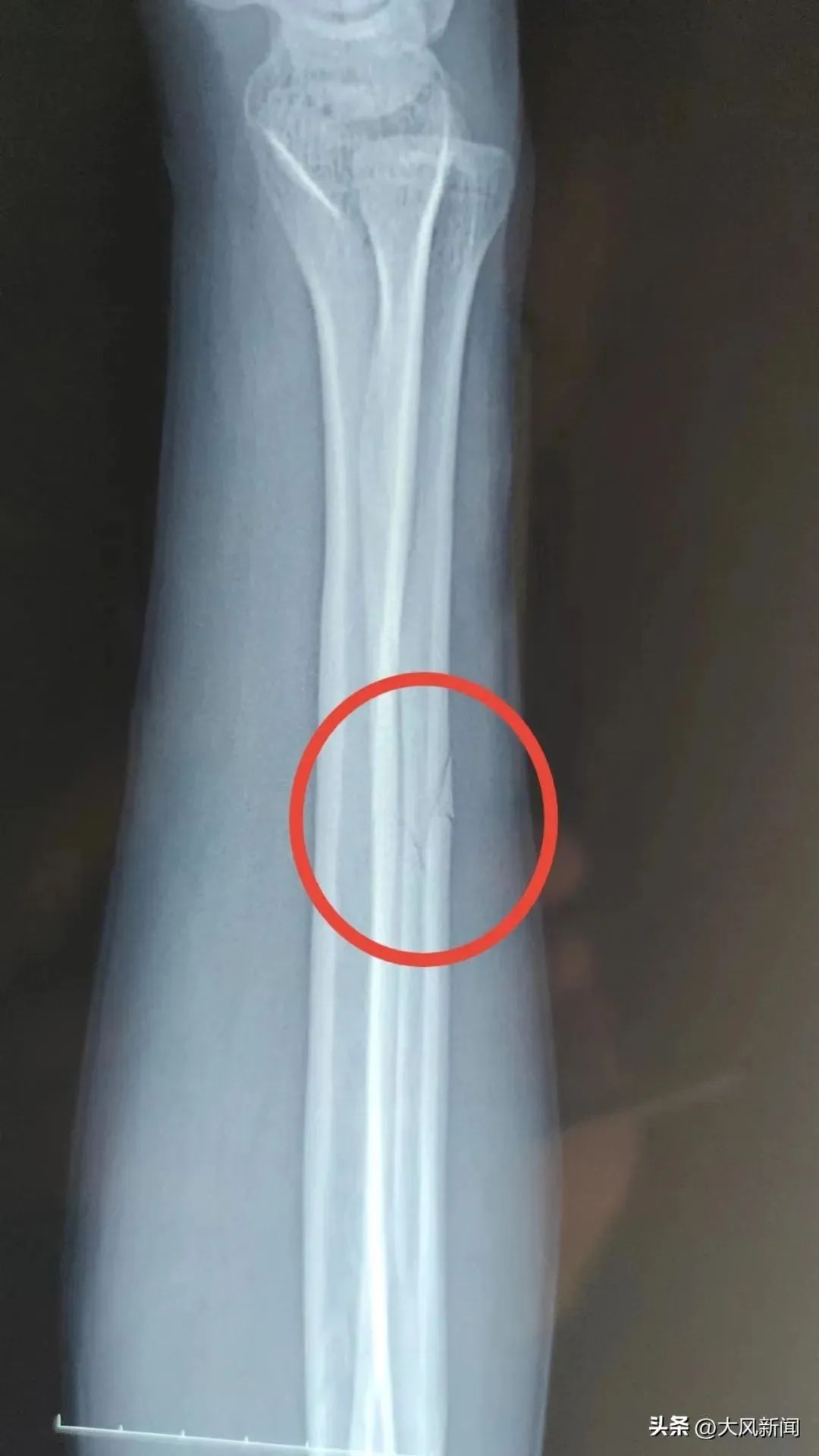 民警酒后殴打残疾人!警方凌晨通报(图3) 4.jpg