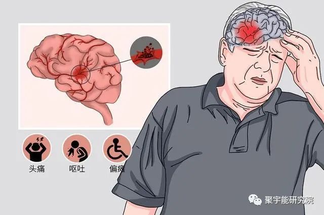 金日光教授:【漫谈《黄帝内经》•之六十六】脑溢血和脑出血的病机有什么差别?中药能预防?能治疗?(图1) 48.jpg