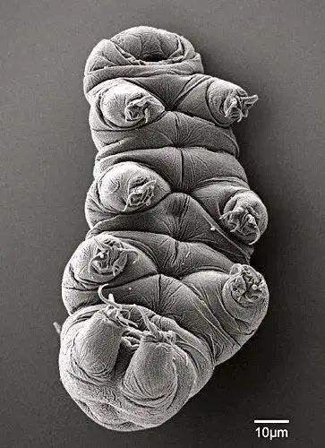 小小的微生物放大了竟然如此可怕——显微镜下的微型生物(图5) 7.jpg