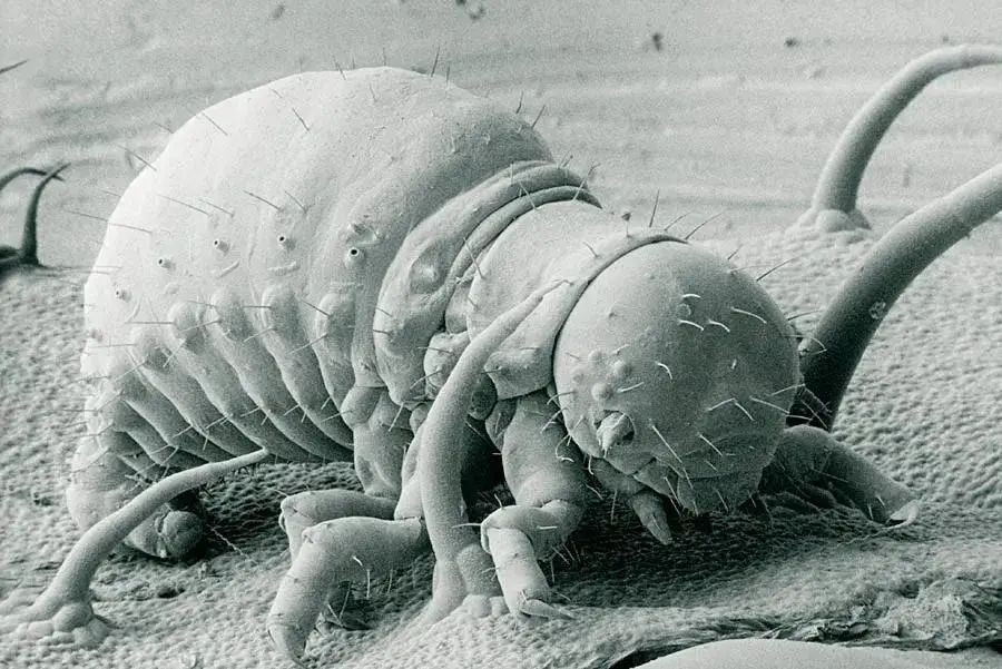 小小的微生物放大了竟然如此可怕——显微镜下的微型生物(图9) 11.jpg