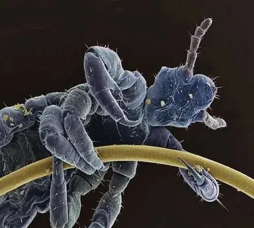 小小的微生物放大了竟然如此可怕——显微镜下的微型生物(图23) 25.jpg