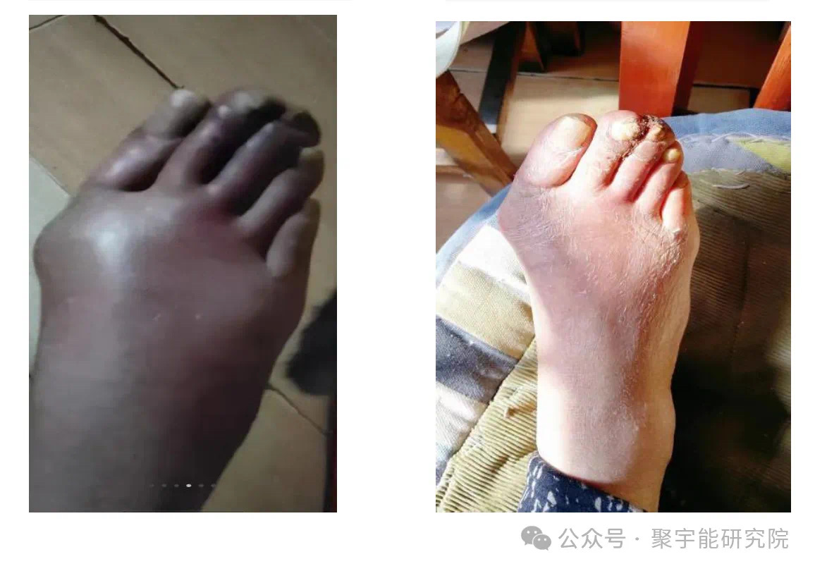 金日光教授:【《黄帝内经》所深藏的奥秘•之六十八】有些群友问我<布世出>对心脑血管,糖尿病等方面有啥作用?(图4) 33.jpg