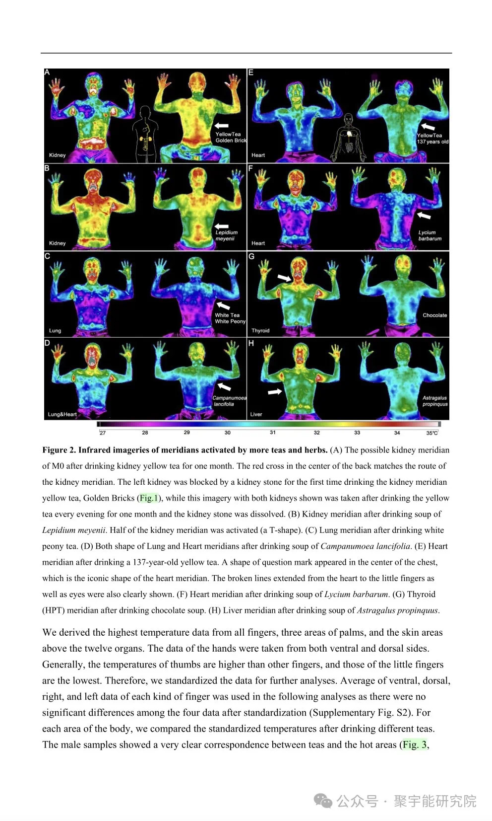 金日光教授:【《黄帝内经》所深藏的奥秘•之七十六】有些群友问我钱老对费伦教授的经络研究有什么看法?(图33) 9.jpg