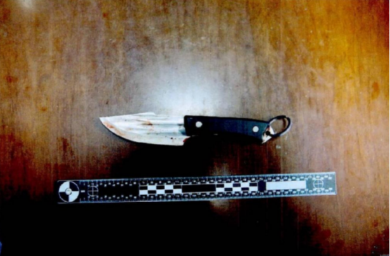 女子整容失败持刀“复仇”,医美中介被捅伤缝100多针(图2) 640.png