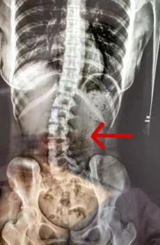 5个无意识的伤身“坏习惯”,很多人每天都在做,自己还不知道!(图2) 2.png