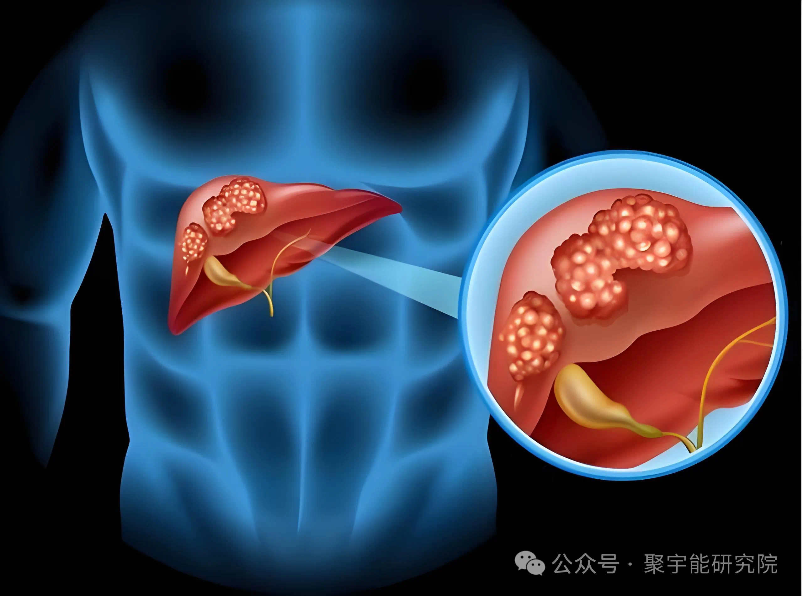 金日光教授:【《黄帝内经》为何是中医大学科最上等的医典?•三十一】从九宫九类特供药看治疗癌症的思路(图3) 13.jpg