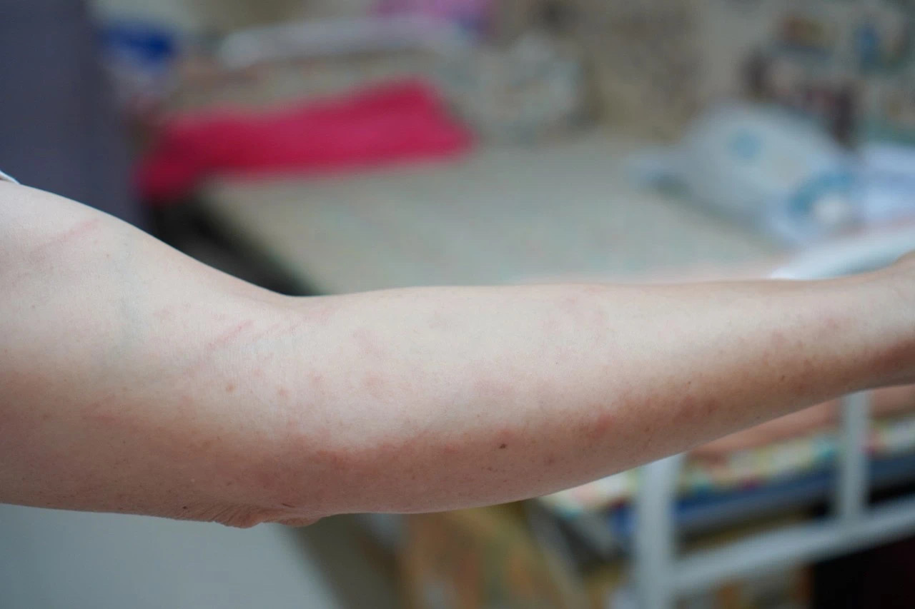 大闸蟹上市!小伙一顿吃7只后入院抢救,医生提醒→(图8) 微信图片7.jpg