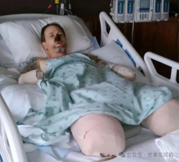 男子被爱犬舔了一口,多器官衰竭死亡!病因不是狂犬病…(图3) 5.png