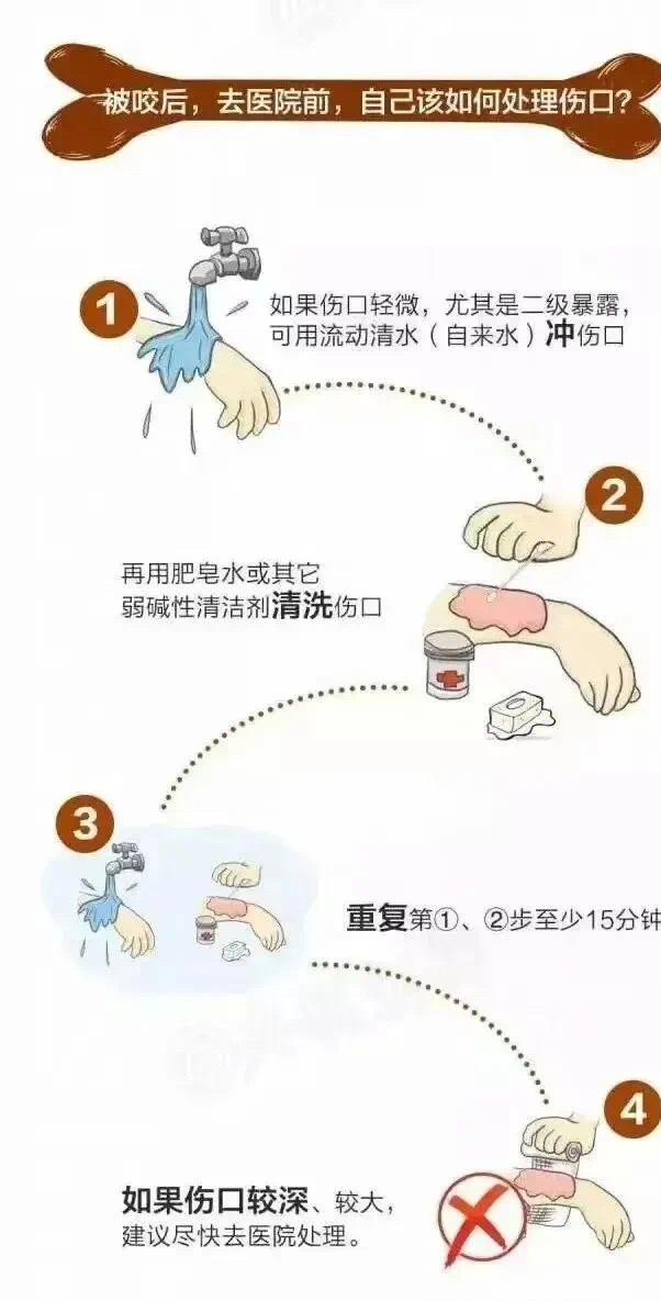 男子被爱犬舔了一口,多器官衰竭死亡!病因不是狂犬病…(图5) 7.jpg