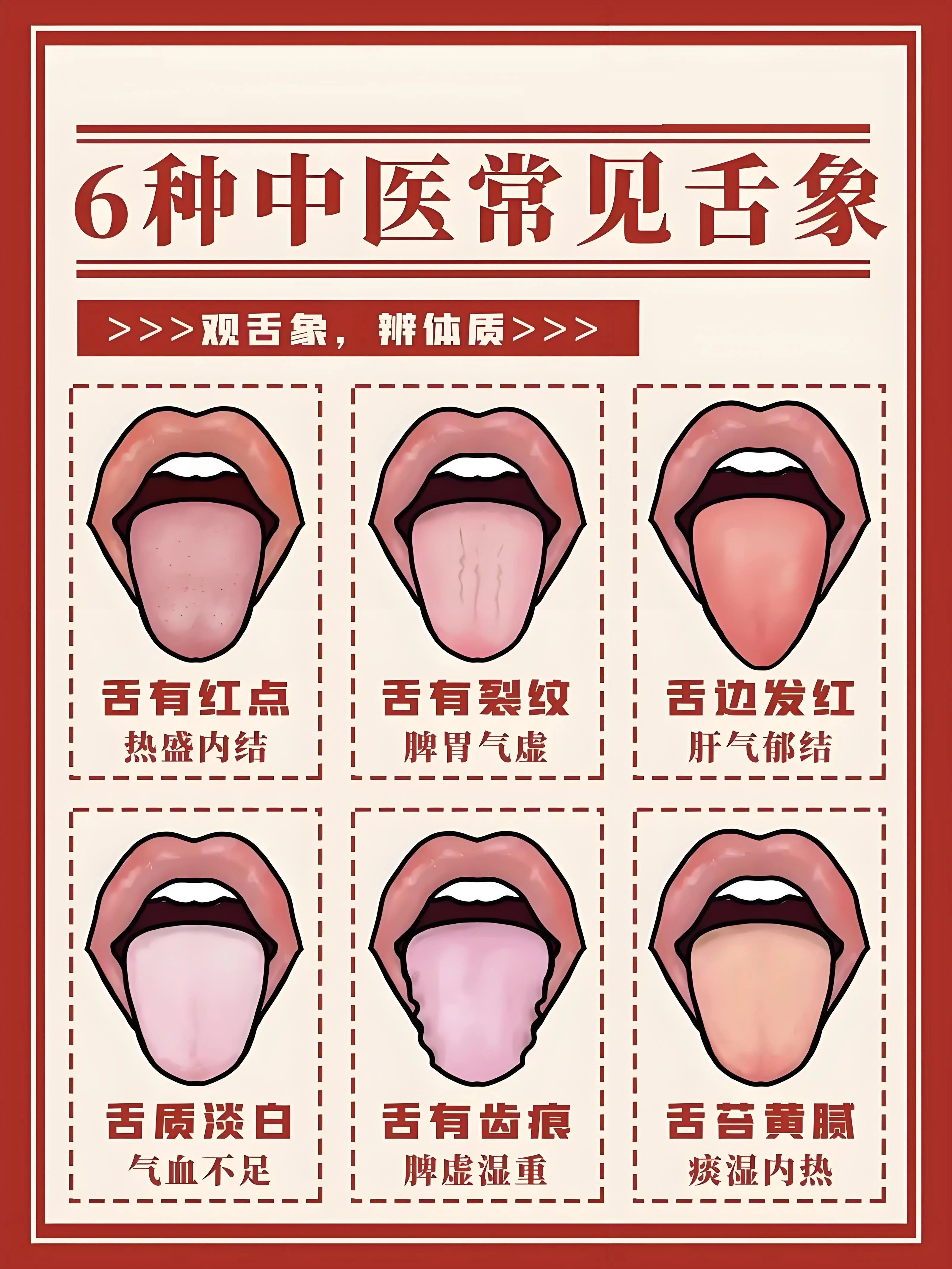 金日光教授:【《黄帝内经》为何是中医大学科最上等的医典?•八十一】怎么理解《内经》和《难经》说的“舌头与、心脏有密切的关系”?(图3) 22.jpg