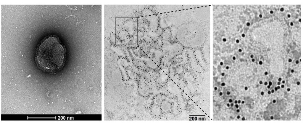 除了发热还致头晕,是“新毒株”吗?专家回应→(图5) 微信图片_20241226211507.jpg