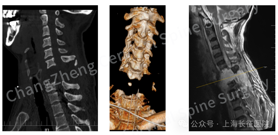 “身首离断”也能救!中国医生缔造“医学奇迹”(图2) 图片