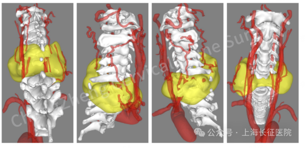 “身首离断”也能救!中国医生缔造“医学奇迹”(图3) 图片