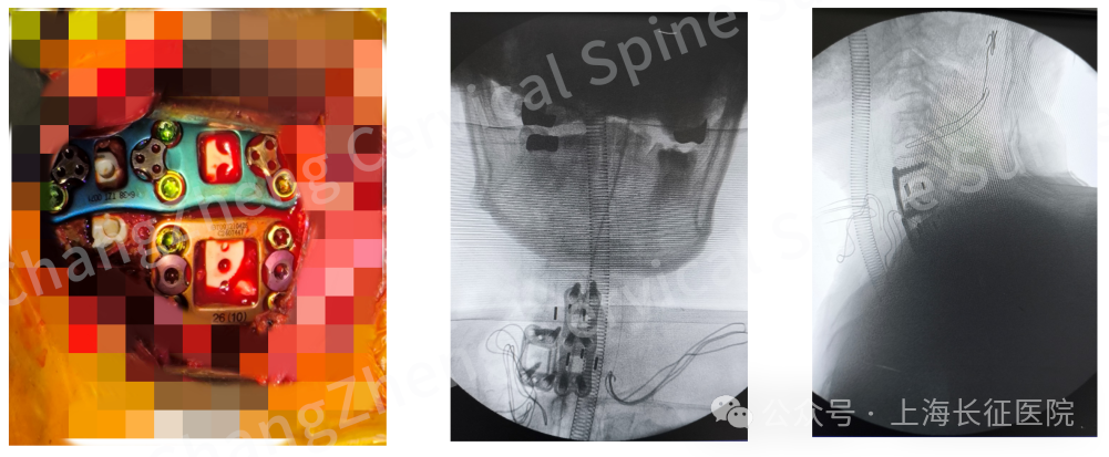 “身首离断”也能救!中国医生缔造“医学奇迹”(图6) 图片