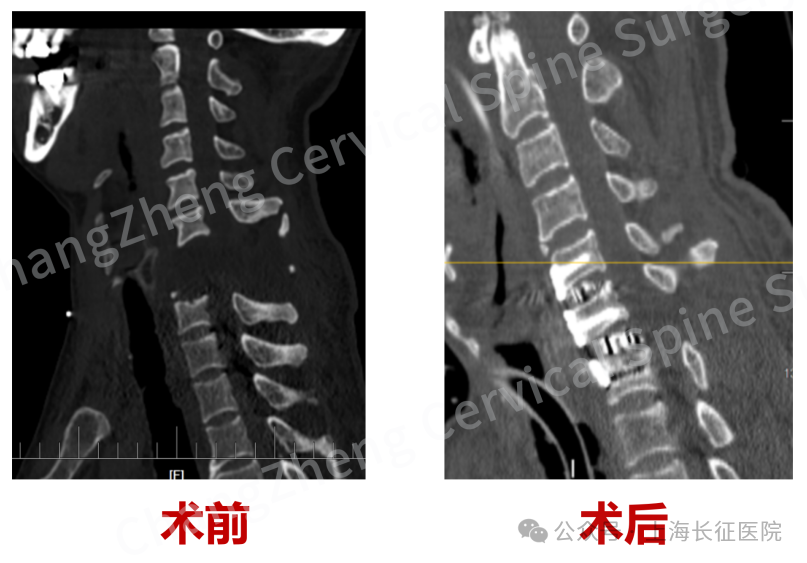 “身首离断”也能救!中国医生缔造“医学奇迹”(图8) 图片