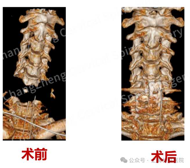 “身首离断”也能救!中国医生缔造“医学奇迹”(图9) 图片