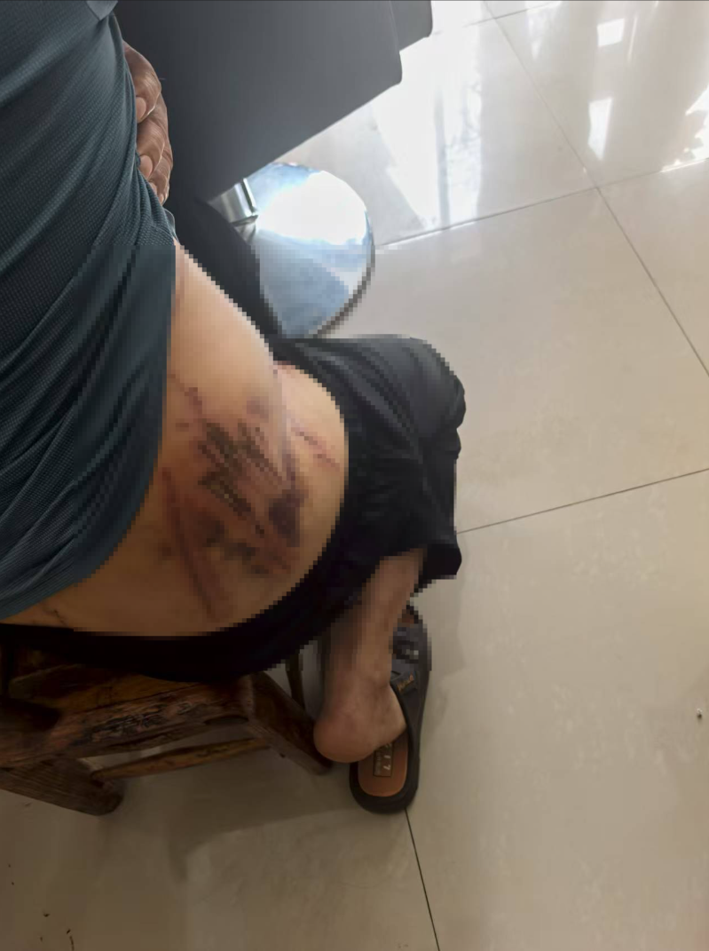 一村民称被“老虎”抓出十余道伤痕,当地最新通报(图2) 图片