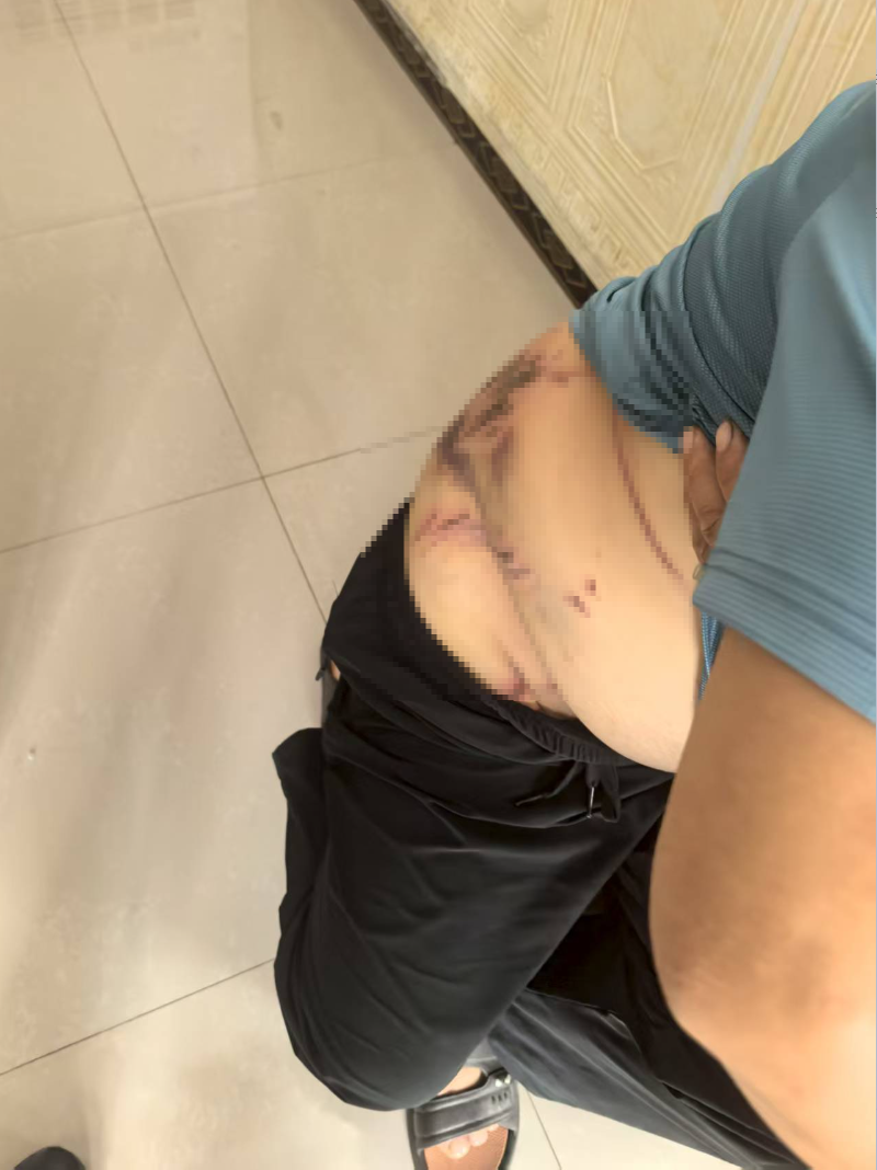 一村民称被“老虎”抓出十余道伤痕,当地最新通报(图3) 图片