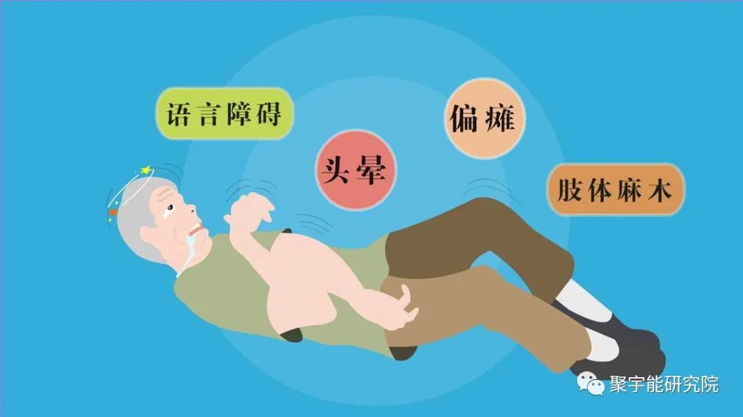 金日光教授:【《黄帝内经》漫谈•之六十三】为什么脑梗偏瘫如此猖獗?有什么好药?(图1) 2.jpg