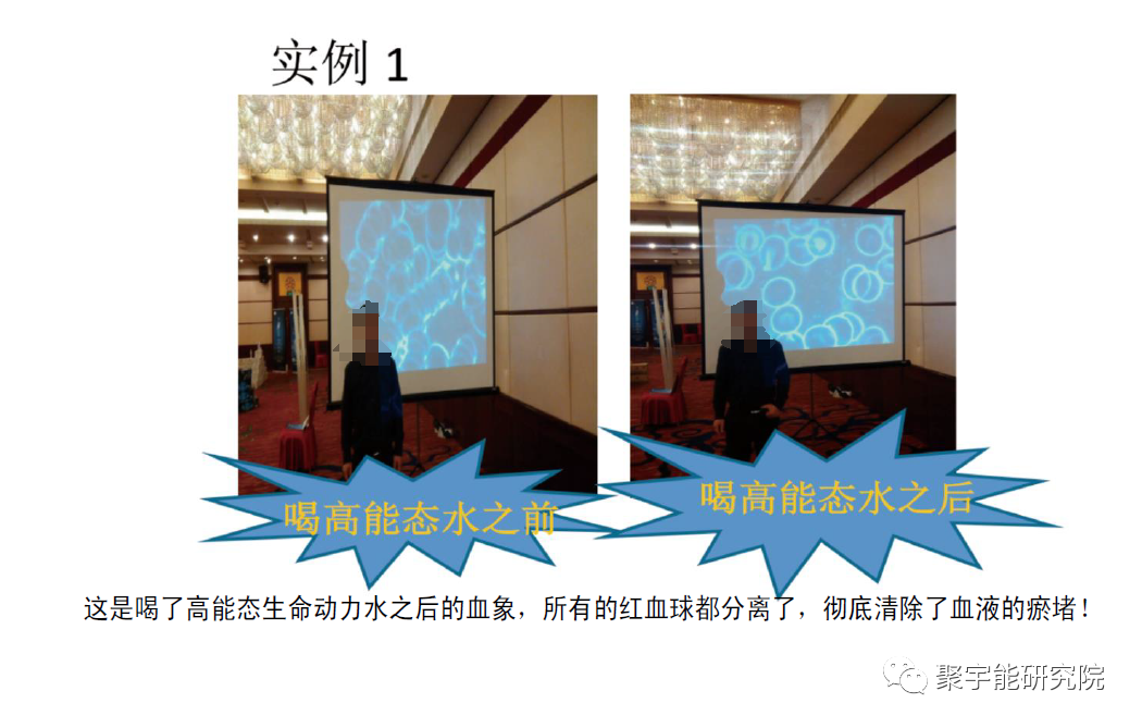 金日光教授:【《黄帝内经》漫谈•之六十三】为什么脑梗偏瘫如此猖獗?有什么好药?(图10) 11.png